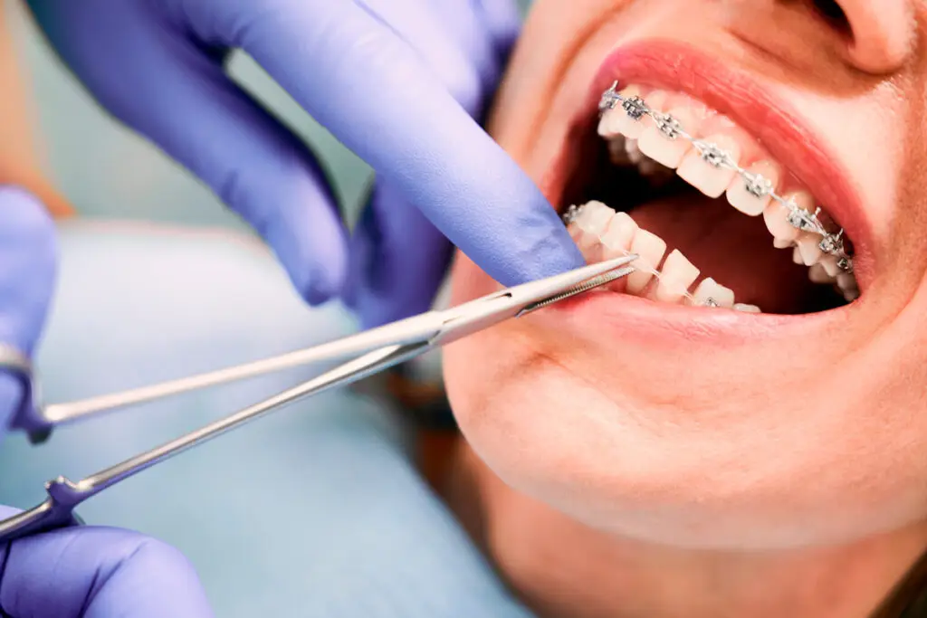 Diş Eti Hastalıkları (Periodontoloji) ve Erken Belirtileri